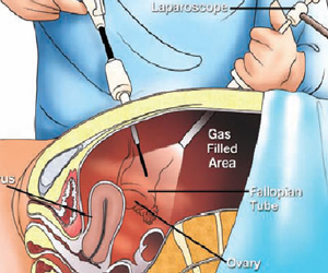 surgical gastroenterology in hyderabad